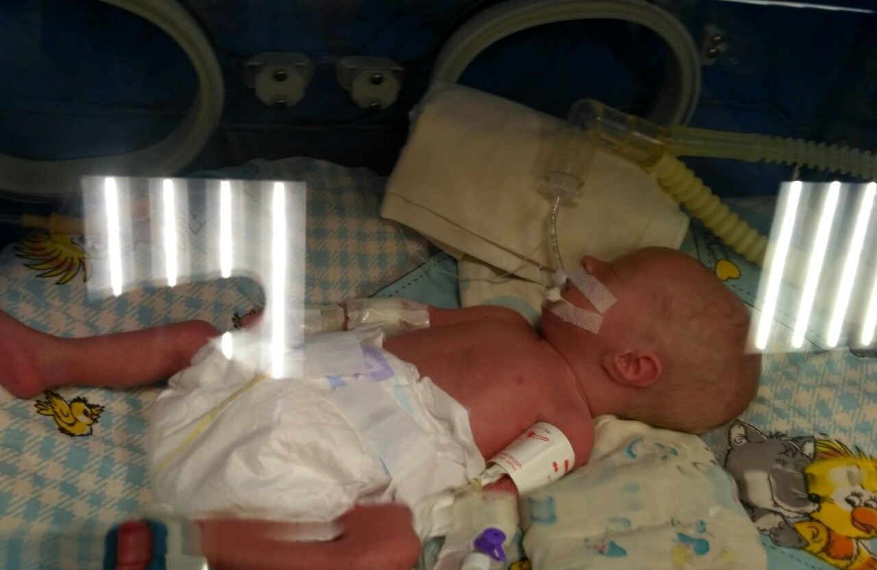 Вісті з Полтави - У Полтаві лікарі намагаються врятувати життя двох недоношених малюків, від яких відмовилася матір